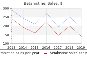 buy betahistine 16 mg