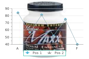 betahistine 16 mg fast delivery