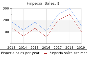 cheap 1 mg finpecia mastercard