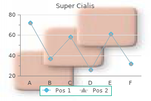 buy super cialis 80 mg mastercard