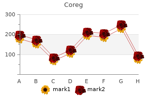 buy coreg 12.5 mg overnight delivery