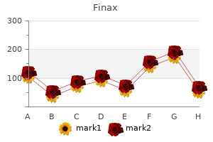 buy cheap finax 1 mg on line