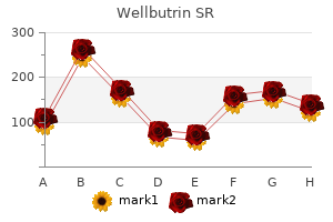 discount 150 mg wellbutrin sr with amex