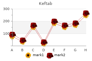 order keftab 500 mg overnight delivery